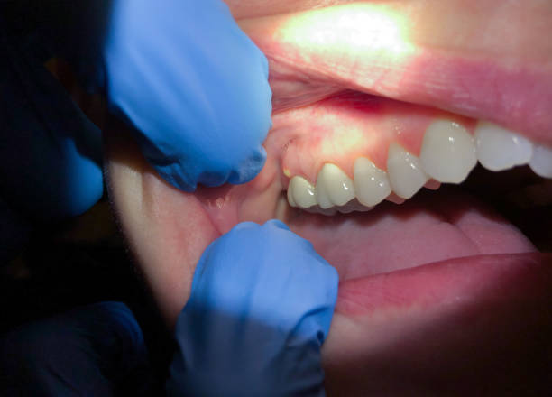 Best Emergency Dental Care for Broken or Chipped Teeth in Quartzsite, AZ